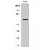 SLC9A9 / NHE9 Antibody - Western blot of NHE-9 antibody