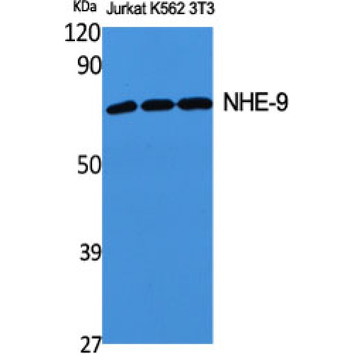 SLC9A9 / NHE9 Antibody - Western blot of NHE-9 antibody