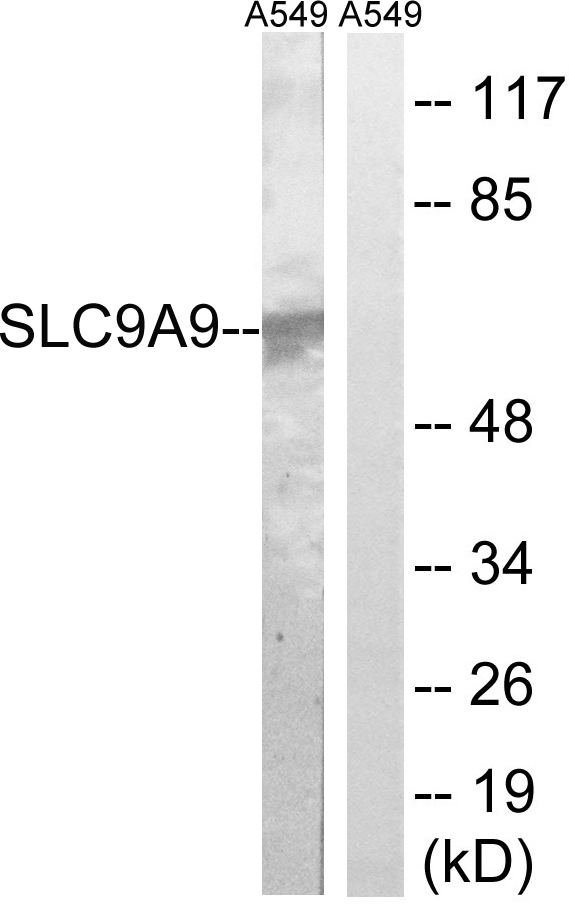 SLC9A9 / NHE9 Antibody - Western blot analysis of lysates from A549 cells, using SLC9A9 Antibody. The lane on the right is blocked with the synthesized peptide.