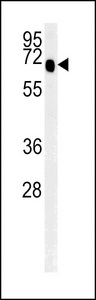 SLC9A9 / NHE9 Antibody - SLC9A9 Antibody western blot of mouse spleen tissue lysates (35 ug/lane). The SLC9A9 antibody detected SLC9A9 protein (arrow).