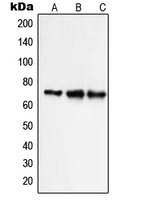 SLC9A9 / NHE9 Antibody - Western blot analysis of NHE9 expression in HepG2 (A); Caco2 HeLa (B); NIH3T3 (C) whole cell lysates.