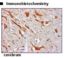 SLC9A9 / NHE9 Antibody