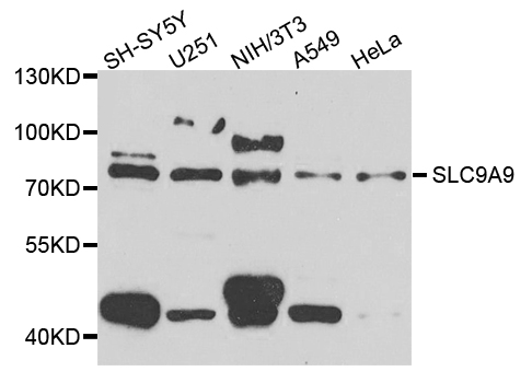 SLC9A9 / NHE9 Antibody - Western blot analysis of extract of various cells.