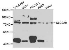 SLC9A9 / NHE9 Antibody - Western blot analysis of extract of various cells.