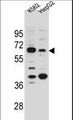 SLC9B1 / NHEDC1 Antibody - NHEDC1 Antibody western blot of K562 and HepG2 cell line lysates (35 ug/lane). The NHEDC1 antibody detected the NHEDC1 protein (arrow).