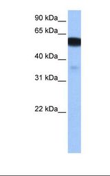 SLC9B1 / NHEDC1 Antibody - Fetal brain cell lysate. Antibody concentration: 0.5 ug/ml. Gel concentration: 12%.  This image was taken for the unconjugated form of this product. Other forms have not been tested.