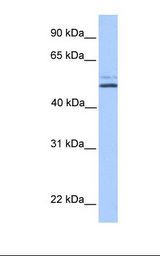 SLC9B2 / NHEDC2 Antibody - NTERA2 cell lysate. Antibody concentration: 1.0 ug/ml. Gel concentration: 12%.  This image was taken for the unconjugated form of this product. Other forms have not been tested.
