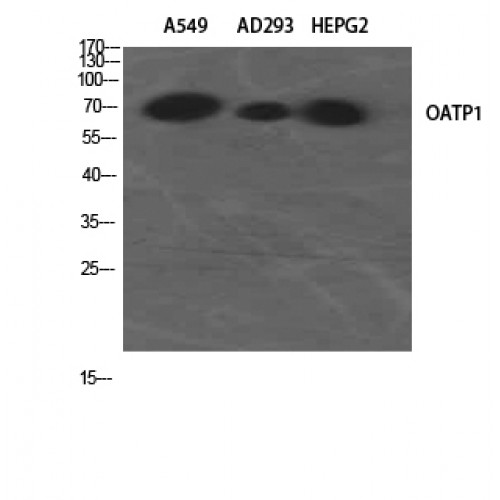 SLCO1A2 / OATP Antibody - Western blot of OATP1 antibody