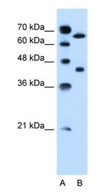 SLCO1A2 / OATP Antibody - Lane A: Marker Lane B: Jurkat Cell Lysate.  This image was taken for the unconjugated form of this product. Other forms have not been tested.