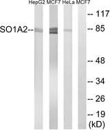 SLCO1A2 / OATP Antibody - Western blot analysis of lysates from HeLa, MCF-7, and HepG2 cells, using SLCO1A2 Antibody. The lane on the right is blocked with the synthesized peptide.