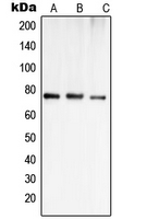 SLCO1A2 / OATP Antibody - Western blot analysis of OATP1 expression in Jurkat (A); MCF7 (B); SHSY5Y (C) whole cell lysates.
