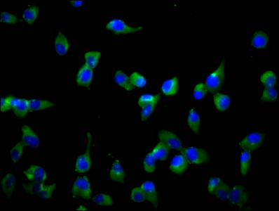 SLCO1A2 / OATP Antibody - Immunofluorescence staining of SH-SY5Y cells diluted at 1:166, counter-stained with DAPI. The cells were fixed in 4% formaldehyde, permeabilized using 0.2% Triton X-100 and blocked in 10% normal Goat Serum. The cells were then incubated with the antibody overnight at 4°C.The Secondary antibody was Alexa Fluor 488-congugated AffiniPure Goat Anti-Rabbit IgG (H+L).