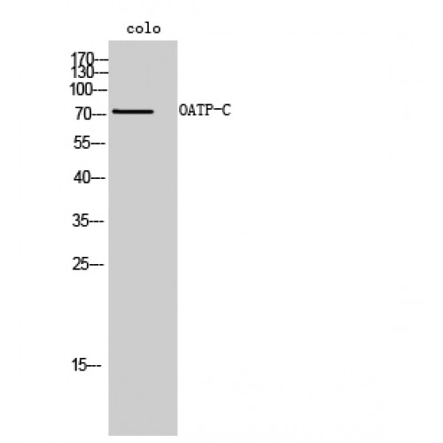 SLCO1B1 / OATP2 Antibody - Western blot of OATP-C antibody
