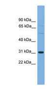 SLCO1B1 / OATP2 Antibody - SLCO1B1 / OATP2 antibody Western blot of HepG2 cell lysate. This image was taken for the unconjugated form of this product. Other forms have not been tested.