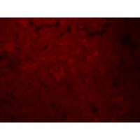 SLCO1B1 / OATP2 Antibody - Immunofluorescence of SLCO1B1 in human liver tissue with SLCO1B1 antibody at 20 µg/ml.