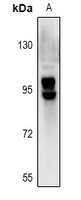 SLCO1B1 / OATP2 Antibody - Western blot analysis of OATP2 expression in LO2 (A) whole cell lysates.
