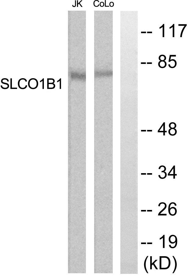 SLCO1B1 / OATP2 Antibody - Western blot analysis of extracts from COLO205 and Jurkat cells, using SLCO1B1 antibody.