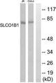 SLCO1B1 / OATP2 Antibody - Western blot analysis of extracts from COLO205 and Jurkat cells, using SLCO1B1 antibody.