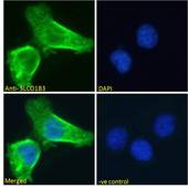 SLCO1B3 / OATP8 Antibody - SLCO1B3 / OATP8 antibody immunofluorescence analysis of paraformaldehyde fixed A431 cells, permeabilized with 0.15% Triton. Primary incubation 1hr (10ug/ml) followed by Alexa Fluor 488 secondary antibody (2ug/ml), showing membrane staining. The nuclear stain is DAPI (blue). Negative control: Unimmunized goat IgG (10ug/ml) followed by Alexa Fluor 488 secondary antibody (2ug/ml).