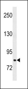 SLCO1B3 / OATP8 Antibody - SLCO1B3 Antibody western blot of NCI-H460 cell line lysates (35 ug/lane). The SLCO1B3 antibody detected the SLCO1B3 protein (arrow).