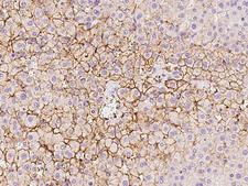 SLCO1B3 / OATP8 Antibody - Immunochemical staining of human SLCO1B3 in human liver with rabbit polyclonal antibody at 1:100 dilution, formalin-fixed paraffin embedded sections.