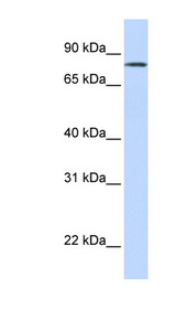 SLCO1B7 Antibody - LST-3TM12 antibody Western blot of Fetal Lung lysate. This image was taken for the unconjugated form of this product. Other forms have not been tested.