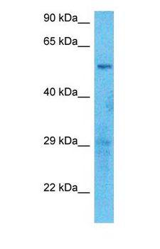 SLCO2B1 Antibody - Western blot of SLCO2B1 Antibody with human U937 Whole Cell lysate.  This image was taken for the unconjugated form of this product. Other forms have not been tested.