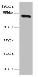 SLCO2B1 Antibody - Western blot All Lanes: SLCO2B1 antibody IgG at 1.5ug/ml+ HepG-2 whole cell lysate Secondary Goat polyclonal to rabbit IgG at 1/10000 dilution Predicted band size: 77,53,75,62 kDa Observed band size: 77 kDa