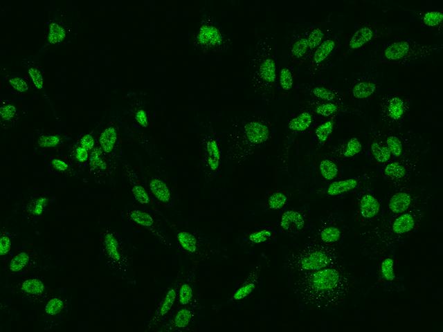 SLCO4C1 Antibody - Immunofluorescence staining of SLCO4C1 in U251MG cells. Cells were fixed with 4% PFA, permeabilzed with 0.1% Triton X-100 in PBS, blocked with 10% serum, and incubated with rabbit anti-Human SLCO4C1 polyclonal antibody (dilution ratio 1:200) at 4°C overnight. Then cells were stained with the Alexa Fluor 488-conjugated Goat Anti-rabbit IgG secondary antibody (green). Positive staining was localized to Nucleus.