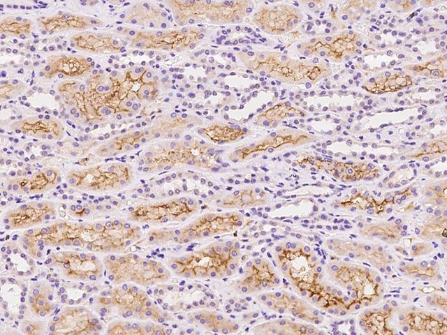 SLCO4C1 Antibody - Immunochemical staining of human SLCO4C1 in human kidney with rabbit polyclonal antibody at 1:100 dilution, formalin-fixed paraffin embedded sections.