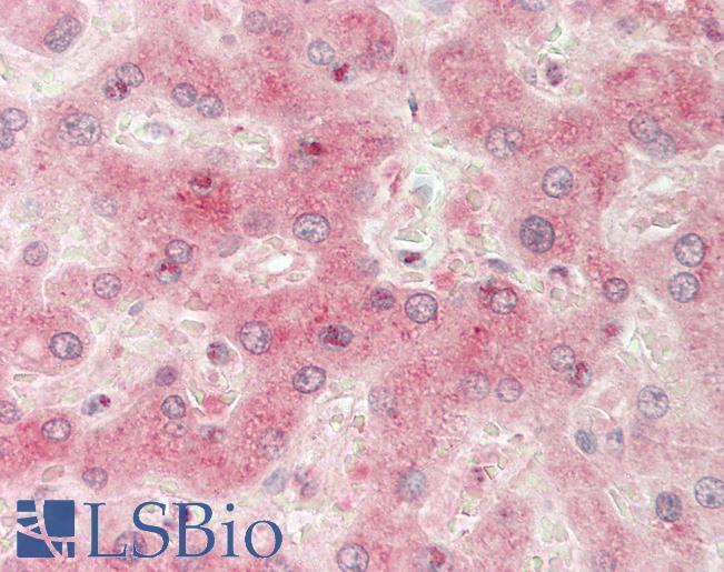SLCO5A1 Antibody - Human Liver: Formalin-Fixed, Paraffin-Embedded (FFPE).  This image was taken for the unconjugated form of this product. Other forms have not been tested.