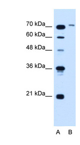 SLCO6A1 / OATP-I Antibody - SLCO6A1 antibody ARP44138_T100-NP_775759-SLCO6A1(solute carrier organic anion transporter family, member 6A1) Antibody Western blot of Jurkat lysate.  This image was taken for the unconjugated form of this product. Other forms have not been tested.