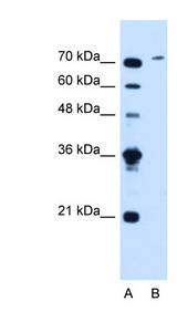 SLCO6A1 / OATP-I Antibody - SLCO6A1 antibody ARP44139_T100-NP_775759-SLCO6A1(solute carrier organic anion transporter family, member 6A1) Antibody Western blot of Jurkat lysate.  This image was taken for the unconjugated form of this product. Other forms have not been tested.