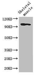 SLFN11 Antibody - Positive WB detected in:Mouse skeletal muscle tissue;All lanes: SLFN11 antibody at 2.8ug/ml;Secondary;Goat polyclonal to rabbit IgG at 1/50000 dilution;Predicted band size: 103 kDa;Observed band size: 103 kDa;