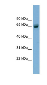 SLFN12 Antibody - SLFN12 antibody Western blot of Fetal Stomach lysate. This image was taken for the unconjugated form of this product. Other forms have not been tested.