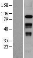SLFN12 Protein - Western validation with an anti-DDK antibody * L: Control HEK293 lysate R: Over-expression lysate