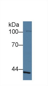 SLFN12L Antibody - Western Blot; Sample: Human Lung lysate; ;Primary Ab: 1µg/ml Rabbit Anti-Human SLFN5 Antibody;Second Ab: 0.2µg/mL HRP-Linked Caprine Anti-Rabbit IgG Polyclonal Antibody;