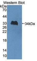 SLFN12L Antibody - Western blot of SLFN12L antibody.
