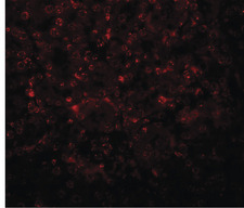 SLFN14 Antibody - Immunofluorescence of SLFN14 in mouse kidney tissue with SLFN14 antibody at 20 ug/ml.