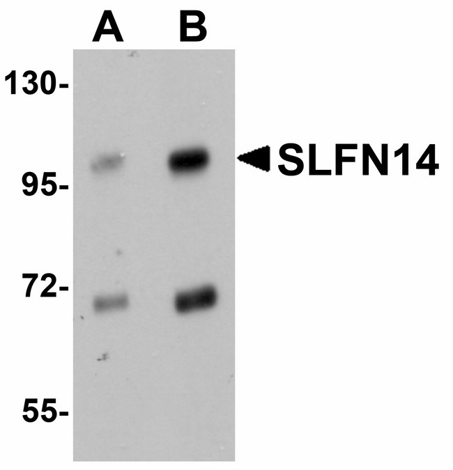 SLFN14 Antibody - Western blot of SLFN14 in mouse kidney tissue lysate with SLFN14 antibody at (A) 1 and (B) 2 ug/ml.