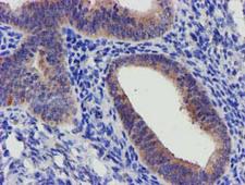 SLFNL1 Antibody - IHC of paraffin-embedded Human endometrium tissue using anti-SLFNL1 mouse monoclonal antibody.