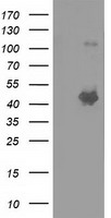 SLFNL1 Antibody - HEK293T cells were transfected with the pCMV6-ENTRY control (Left lane) or pCMV6-ENTRY SLFNL1 (Right lane) cDNA for 48 hrs and lysed. Equivalent amounts of cell lysates (5 ug per lane) were separated by SDS-PAGE and immunoblotted with anti-SLFNL1.