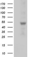 SLFNL1 Antibody - HEK293T cells were transfected with the pCMV6-ENTRY control (Left lane) or pCMV6-ENTRY SLFNL1 (Right lane) cDNA for 48 hrs and lysed. Equivalent amounts of cell lysates (5 ug per lane) were separated by SDS-PAGE and immunoblotted with anti-SLFNL1.