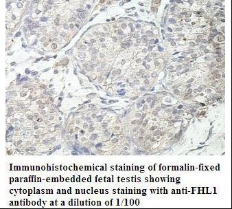 SLIM / FHL1 Antibody