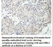 SLIM / FHL1 Antibody