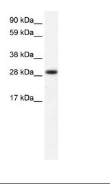 SLIM / FHL1 Antibody - Fetal Muscle Lysate.  This image was taken for the unconjugated form of this product. Other forms have not been tested.