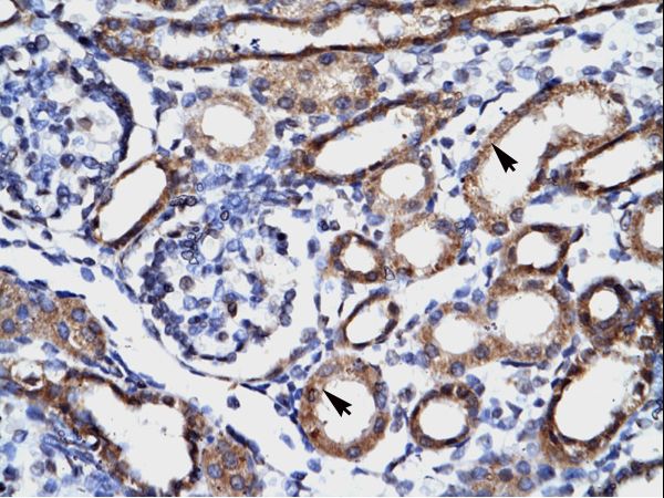 SLIM / FHL1 Antibody - FHL1 antibody ARP34378_T100-NP_001440-FHL1 (four and a half LIM domains 1) Antibody was used in IHC to stain formalin-fixed, paraffin-embedded human kidney.  This image was taken for the unconjugated form of this product. Other forms have not been tested.