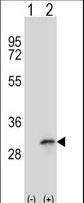 SLIM / FHL1 Antibody - Western blot of FHL1 (arrow) using rabbit polyclonal FHL1 Antibody. 293 cell lysates (2 ug/lane) either nontransfected (Lane 1) or transiently transfected (Lane 2) with the FHL1 gene.