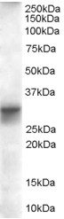 SLIM / FHL1 Antibody - Antibody (0.01 ug/ml) staining of Human Heart lysate (35 ug protein in RIPA buffer). Primary incubation was 1 hour. Detected by chemiluminescence.