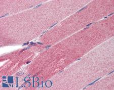 SLIM / FHL1 Antibody - Anti-FHL1 antibody IHC of human skeletal muscle. Immunohistochemistry of formalin-fixed, paraffin-embedded tissue after heat-induced antigen retrieval. Antibody concentration 5 ug/ml.  This image was taken for the unconjugated form of this product. Other forms have not been tested.